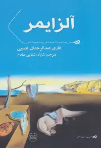 آلزایمر