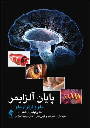 پایان آلزایمر
مغز و فراتر از مغز | توماس جی. لوئیس, کلمنت ترمپ | نشر انتشارات ارجمند