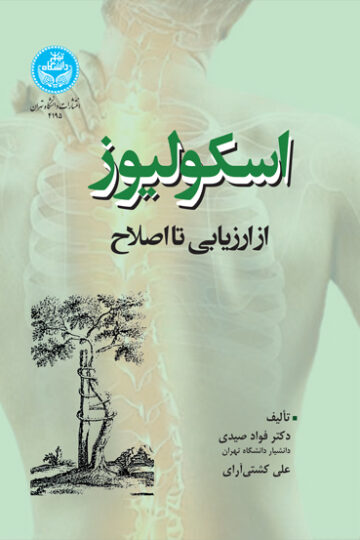 اسکولیوز؛ از ارزیابی تا اصلاح | نشر دانشگاه تهران