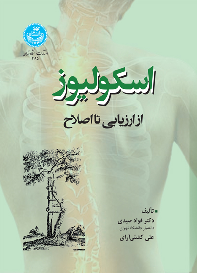 اسکولیوز؛ از ارزیابی تا اصلاح | نشر دانشگاه تهران