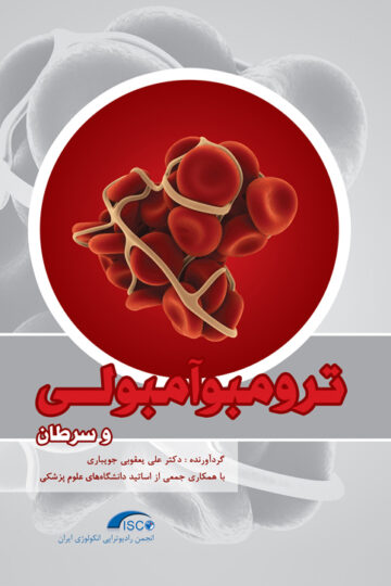 ترومبوآمبولی و سرطان