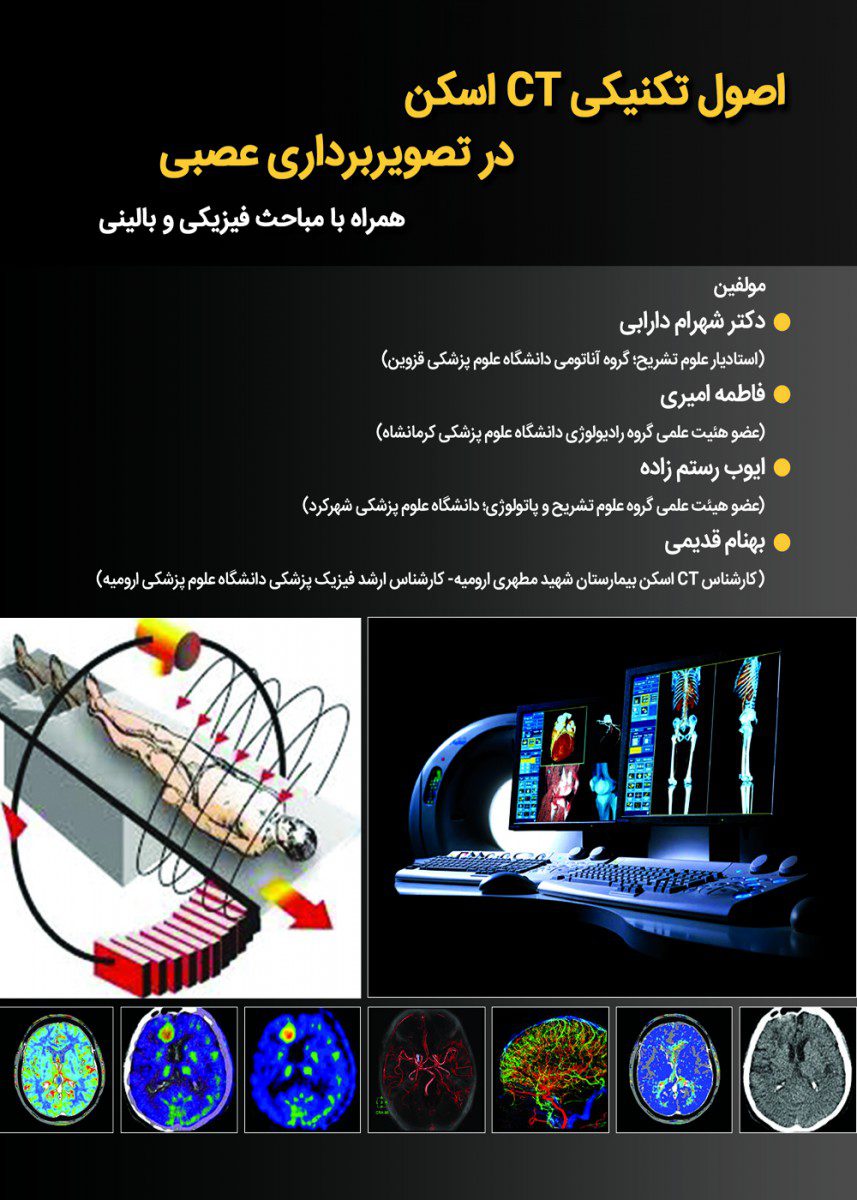 اصول تکنیکی CT اسکن در تصویر برداری عصبی