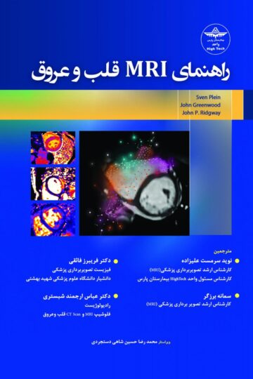 راهنمای MRI قلب و عروق