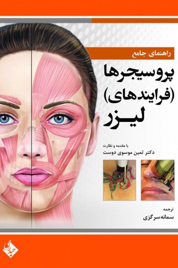 راهنمای جامع پروسیجرها (فرایندهای) لیزر