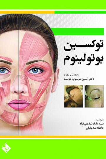 توکسین بوتولینوم