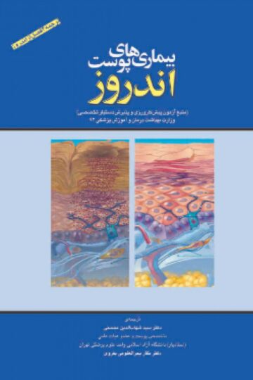 بیماریهای پوست اندروز