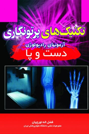 تکنیک های پرتونگاری دست و پا