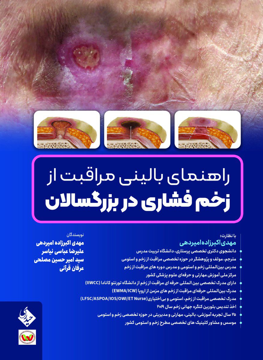 راهنمای بالینی مراقبت از زخم فشاری در بزرگسالان
