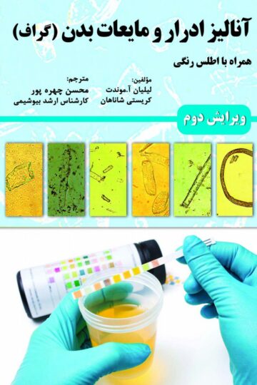 آنالیز ادرار و مایعات بدن (گراف)