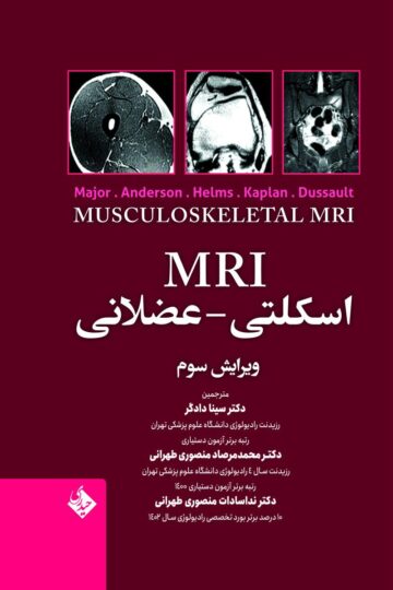 MRI اسکلتی – عضلانی