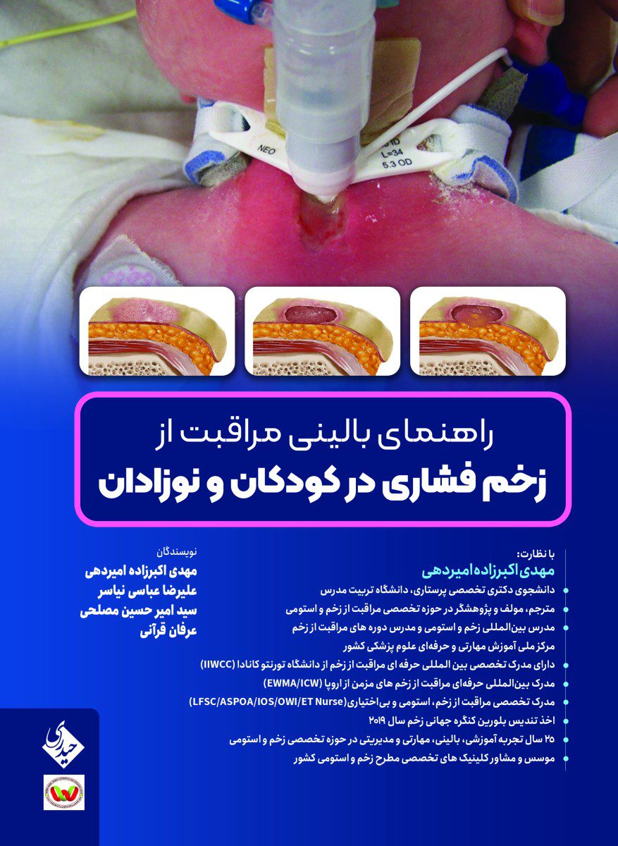 راهنمای بالینی مراقبت از زخم فشاری در کودکان و نوزادان