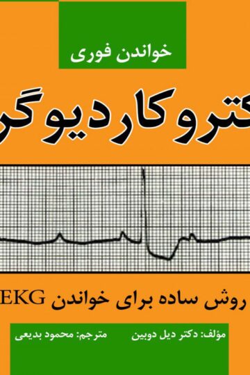 خواندن فوری الکتروکاردیوگرام